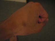 120-2034_IMG